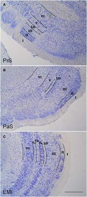 The Human Periallocortex: Layer Pattern in Presubiculum, Parasubiculum and Entorhinal Cortex. A Review